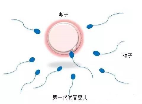 精液分析